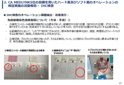 令和６年度「ケニアにおけるがん診断アクセス普及のための基礎プロジェクト」事業報告書